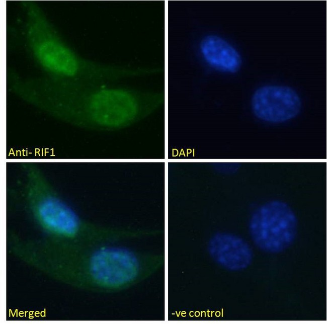 RIF1 Antibody - RIF1 antibody immunofluorescence analysis of paraformaldehyde fixed U2OS cells, permeabilized with 0.15% Triton. Primary incubation 1hr (10ug/ml) followed by Alexa Fluor 488 secondary antibody (2ug/ml), showing nuclear staining. The nuclear stain is DAPI (blue). Negative control: Unimmunized goat IgG (10ug/ml) followed by Alexa Fluor 488 secondary antibody (2ug/ml).