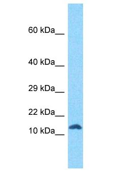 RIIAD1 Antibody - RIIAD1 antibody Western Blot of Jurkat. Antibody dilution: 1 ug/ml.  This image was taken for the unconjugated form of this product. Other forms have not been tested.