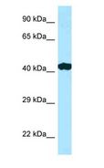 RILP Antibody - RILP antibody Western Blot of Placenta.  This image was taken for the unconjugated form of this product. Other forms have not been tested.
