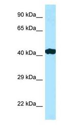 RILP Antibody - RILP antibody Western Blot of Placenta.  This image was taken for the unconjugated form of this product. Other forms have not been tested.