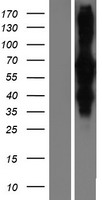 RILP Protein - Western validation with an anti-DDK antibody * L: Control HEK293 lysate R: Over-expression lysate
