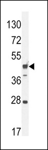 RILPL1 Antibody - RILPL1 Antibody western blot of mouse heart tissue lysates (35 ug/lane). The RILPL1 antibody detected the RILPL1 protein (arrow).