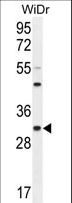 RILPL2 Antibody - RILPL2 Antibody western blot of WiDr cell line lysates (35 ug/lane). The RILPL2 antibody detected the RILPL2 protein (arrow).