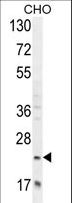 RILPL2 Antibody - RILPL2 Antibody western blot of CHO cell line lysates (35 ug/lane). The RILPL2 antibody detected the RILPL2 protein (arrow).