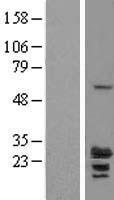 RILPL2 Protein - Western validation with an anti-DDK antibody * L: Control HEK293 lysate R: Over-expression lysate