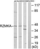 RIMKLA Antibody - Western blot analysis of lysates from HUVEC, COS, and Jurkat cells, using RIMKA Antibody. The lane on the right is blocked with the synthesized peptide.