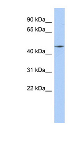 RIMKLA Antibody - RIMKLA antibody Western blot of MCF7 cell lysate. This image was taken for the unconjugated form of this product. Other forms have not been tested.