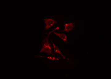 RIMKLA Antibody - Staining HuvEc cells by IF/ICC. The samples were fixed with PFA and permeabilized in 0.1% Triton X-100, then blocked in 10% serum for 45 min at 25°C. The primary antibody was diluted at 1:200 and incubated with the sample for 1 hour at 37°C. An Alexa Fluor 594 conjugated goat anti-rabbit IgG (H+L) antibody, diluted at 1/600, was used as secondary antibody.