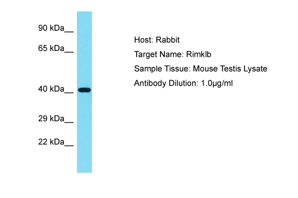 RIMKLB Antibody -  This image was taken for the unconjugated form of this product. Other forms have not been tested.