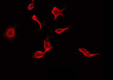 RIMKLB Antibody - Staining HepG2 cells by IF/ICC. The samples were fixed with PFA and permeabilized in 0.1% Triton X-100, then blocked in 10% serum for 45 min at 25°C. The primary antibody was diluted at 1:200 and incubated with the sample for 1 hour at 37°C. An Alexa Fluor 594 conjugated goat anti-rabbit IgG (H+L) Ab, diluted at 1/600, was used as the secondary antibody.