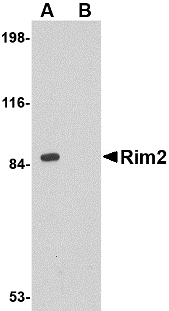 RIMS2 / RIM2 Antibody - Western blot of Rim2 in rat brain tissue lysate with Rim2 antibody at 1 ug/ml in the (A) absence or (B) presence of blocking peptide.