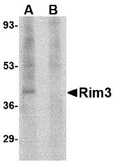 RIMS3 Antibody - Western blot of Rim3 in human brain tissue lysate with Rim3 antibody at 1 ug/ml in the (A) absence and (B) presence of blocking peptide.