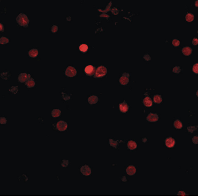 RIMS3 Antibody - Immunofluorescence of rim3 in human brain tissue with rim3 antibody at 5 ug/ml.