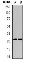 RIMS4 Antibody - Western blot analysis of RIMS4 expression in HeLa (A); NIH3T3 (B) whole cell lysates.