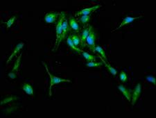 RIN1 Antibody - Immunofluorescence staining of Hela cells at a dilution of 1:133, counter-stained with DAPI. The cells were fixed in 4% formaldehyde, permeabilized using 0.2% Triton X-100 and blocked in 10% normal Goat Serum. The cells were then incubated with the antibody overnight at 4 °C.The secondary antibody was Alexa Fluor 488-congugated AffiniPure Goat Anti-Rabbit IgG (H+L) .