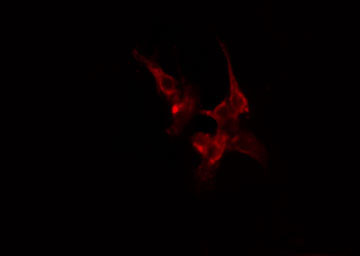 RIN1 Antibody - Staining HeLa cells by IF/ICC. The samples were fixed with PFA and permeabilized in 0.1% Triton X-100, then blocked in 10% serum for 45 min at 25°C. The primary antibody was diluted at 1:200 and incubated with the sample for 1 hour at 37°C. An Alexa Fluor 594 conjugated goat anti-rabbit IgG (H+L) antibody, diluted at 1/600, was used as secondary antibody.
