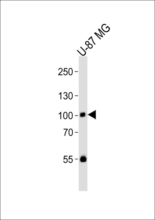 RIN1 Antibody - Western blot of lysate from U-87 MG cell line with Phospho-HUMAN-RIN1 (Y36). control. Antibody was diluted at 1:1000. A goat anti-rabbit IgG H&L (HRP) at 1:10000 dilution was used as the secondary antibody. Lysate at 35 ug.