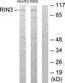 RIN3 Antibody - Western blot analysis of lysates from HUVEC and K562 cells, using RIN3 Antibody. The lane on the right is blocked with the synthesized peptide.