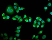 RIN3 Antibody - Immunofluorescence staining of Hela cells diluted at 1:133, counter-stained with DAPI. The cells were fixed in 4% formaldehyde, permeabilized using 0.2% Triton X-100 and blocked in 10% normal Goat Serum. The cells were then incubated with the antibody overnight at 4°C.The Secondary antibody was Alexa Fluor 488-congugated AffiniPure Goat Anti-Rabbit IgG (H+L).