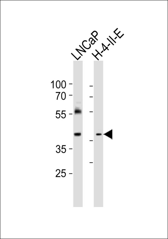 RING1 Antibody - Western blot of lysates from LNCaP, rat H-4-II-E cell line (from left to right) with RING1 Antibody. Antibody was diluted at 1:1000 at each lane. A goat anti-rabbit IgG H&L (HRP) at 1:10000 dilution was used as the secondary antibody. Lysates at 20 ug per lane.
