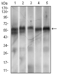 RING1 Antibody - Western blot using Ring1 mouse monoclonal antibody against MOLT-4 (1), LNCaP (2), HeLa (3), HEK-293 (4) and Jurkat (5) cell lysate.