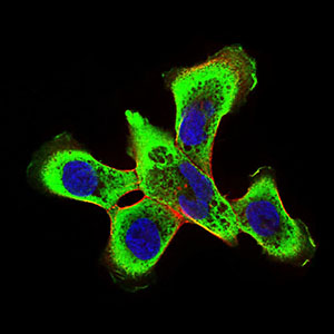 RING1 Antibody - Immunofluorescence of A431 cells using Ring1 mouse monoclonal antibody (green). Blue: DRAQ5 fluorescent DNA dye. Red: Actin filaments have been labeled with Alexa Fluor-555 phalloidin.