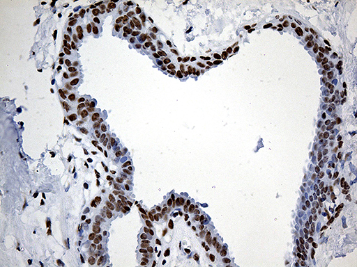 RING1 Antibody - Immunohistochemical staining of paraffin-embedded Human breast tissue within the normal limits using anti-RING1 mouse monoclonal antibody. (Heat-induced epitope retrieval by 1mM EDTA in 10mM Tris buffer. (pH8.5) at 120°C for 3 min. (1:2000)