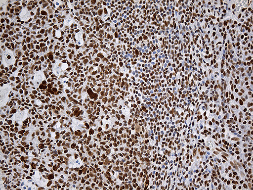 RING1 Antibody - Immunohistochemical staining of paraffin-embedded Human tonsil within the normal limits using anti-RING1 mouse monoclonal antibody. (Heat-induced epitope retrieval by 1mM EDTA in 10mM Tris buffer. (pH8.5) at 120°C for 3 min. (1:2000)