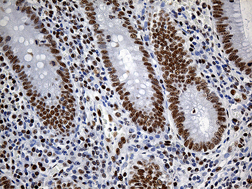 RING1 Antibody - Immunohistochemical staining of paraffin-embedded Human appendix tissue within the normal limits using anti-RING1 mouse monoclonal antibody. (Heat-induced epitope retrieval by 1mM EDTA in 10mM Tris buffer. (pH8.5) at 120°C for 3 min. (1:2000)