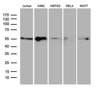 RING1 Antibody - Western blot analysis of extracts. (35ug) from 5 cell lines by using anti-RING1 monoclonal antibody. (1:500)