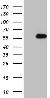 RING1 Antibody - HEK293T cells were transfected with the pCMV6-ENTRY control. (Left lane) or pCMV6-ENTRY RING1. (Right lane) cDNA for 48 hrs and lysed. Equivalent amounts of cell lysates. (5 ug per lane) were separated by SDS-PAGE and immunoblotted with anti-RING1. (1:2000)