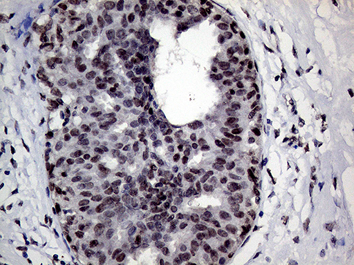 RING1 Antibody - Immunohistochemical staining of paraffin-embedded Human breast tissue within the normal limits using anti-RING1 mouse monoclonal antibody. (Heat-induced epitope retrieval by 1mM EDTA in 10mM Tris buffer. (pH8.5) at 120°C for 3 min. (1:250)