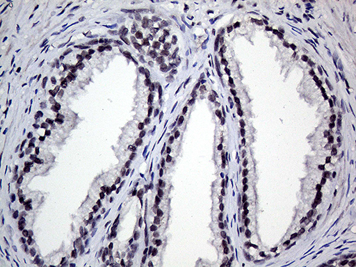 RING1 Antibody - Immunohistochemical staining of paraffin-embedded Human prostate tissue within the normal limits using anti-RING1 mouse monoclonal antibody. (Heat-induced epitope retrieval by 1mM EDTA in 10mM Tris buffer. (pH8.5) at 120°C for 3 min. (1:250)
