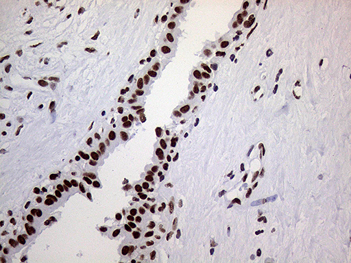 RING1 Antibody - Immunohistochemical staining of paraffin-embedded Human breast tissue within the normal limits using anti-RING1 mouse monoclonal antibody. (Heat-induced epitope retrieval by 1mM EDTA in 10mM Tris buffer. (pH8.5) at 120°C for 3 min. (1:1000)
