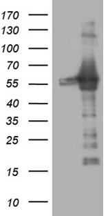 RING1 Antibody - HEK293T cells were transfected with the pCMV6-ENTRY control. (Left lane) or pCMV6-ENTRY RING1. (Right lane) cDNA for 48 hrs and lysed. Equivalent amounts of cell lysates. (5 ug per lane) were separated by SDS-PAGE and immunoblotted with anti-RING1. (1:2000)