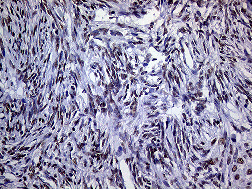 RING1 Antibody - Immunohistochemical staining of paraffin-embedded Human Ovary tissue within the normal limits using anti-RING1 mouse monoclonal antibody. (Heat-induced epitope retrieval by 1mM EDTA in 10mM Tris buffer. (pH8.5) at 120°C for 3 min. (1:1000)