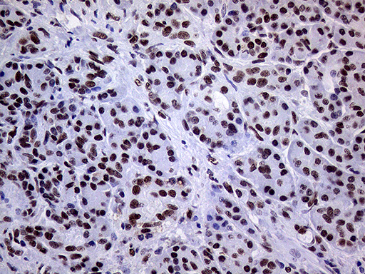 RING1 Antibody - Immunohistochemical staining of paraffin-embedded Human pancreas tissue within the normal limits using anti-RING1 mouse monoclonal antibody. (Heat-induced epitope retrieval by 1mM EDTA in 10mM Tris buffer. (pH8.5) at 120°C for 3 min. (1:1000)