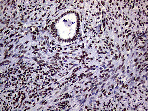 RING1 Antibody - Immunohistochemical staining of paraffin-embedded Human endometrium tissue within the normal limits using anti-RING1 mouse monoclonal antibody. (Heat-induced epitope retrieval by 1mM EDTA in 10mM Tris buffer. (pH8.5) at 120°C for 3 min. (1:1000)