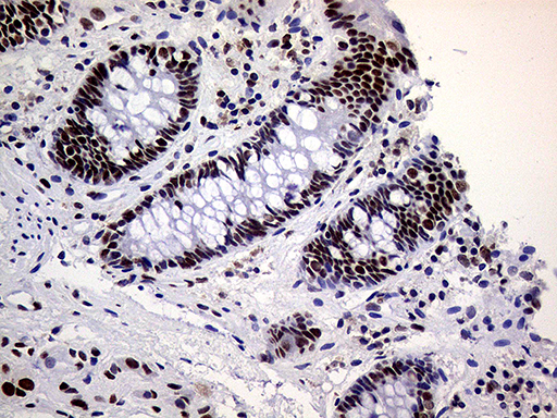 RING1 Antibody - Immunohistochemical staining of paraffin-embedded Human colon tissue within the normal limits using anti-RING1 mouse monoclonal antibody. (Heat-induced epitope retrieval by 1mM EDTA in 10mM Tris buffer. (pH8.5) at 120°C for 3 min. (1:1000)