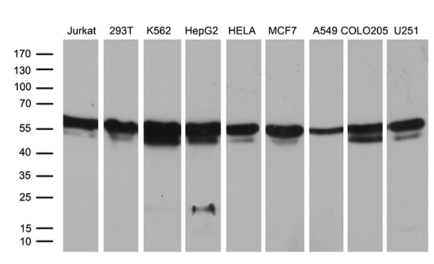 RING1 Antibody - Western blot analysis of extracts. (35ug) from 9 different cell lines by using anti-RING1 monoclonal antibody. (1:500)