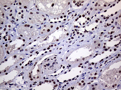 RING1 Antibody - Immunohistochemical staining of paraffin-embedded Human Kidney tissue within the normal limits using anti-RING1 mouse monoclonal antibody. (Heat-induced epitope retrieval by 1mM EDTA in 10mM Tris buffer. (pH8.5) at 120°C for 3 min. (1:1000)