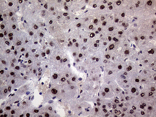 RING1 Antibody - Immunohistochemical staining of paraffin-embedded Human liver tissue within the normal limits using anti-RING1 mouse monoclonal antibody. (Heat-induced epitope retrieval by 1mM EDTA in 10mM Tris buffer. (pH8.5) at 120°C for 3 min. (1:1000)