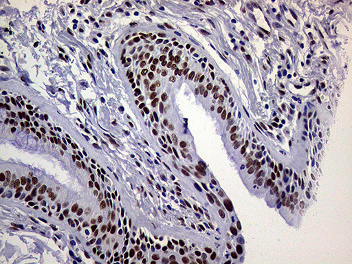 RING1 Antibody - Immunohistochemical staining of paraffin-embedded Human lung tissue within the normal limits using anti-RING1 mouse monoclonal antibody. (Heat-induced epitope retrieval by 1mM EDTA in 10mM Tris buffer. (pH8.5) at 120°C for 3 min. (1:1000)