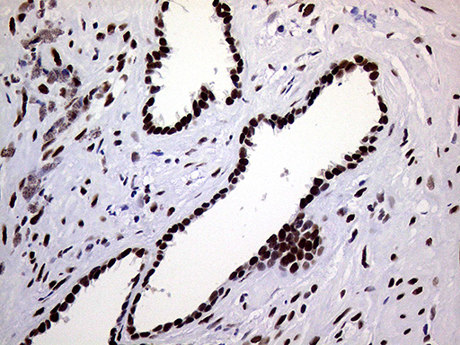 RING1 Antibody - Immunohistochemical staining of paraffin-embedded Human prostate tissue within the normal limits using anti-RING1 mouse monoclonal antibody. (Heat-induced epitope retrieval by 1mM EDTA in 10mM Tris buffer. (pH8.5) at 120°C for 3 min. (1:1000)