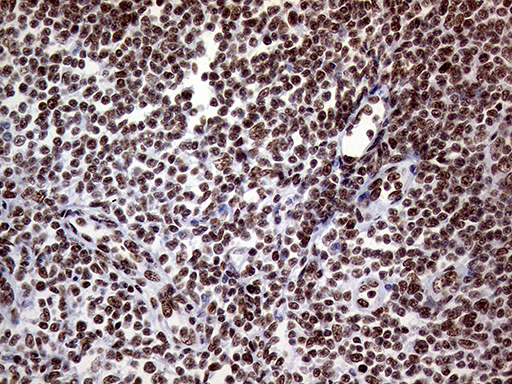 RING1 Antibody - Immunohistochemical staining of paraffin-embedded Human lymph node tissue within the normal limits using anti-RING1 mouse monoclonal antibody. (Heat-induced epitope retrieval by 1mM EDTA in 10mM Tris buffer. (pH8.5) at 120°C for 3 min. (1:1000)