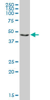 RING1 Antibody - RING1 monoclonal antibody (M09), clone 1D5. Western blot of RING1 expression in HeLa NE.