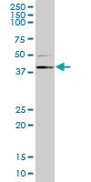 RING1 Antibody - RING1 monoclonal antibody (M10), clone 1F4. Western blot of RING1 expression in HeLa NE.