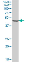 RING1 Antibody - RING1 monoclonal antibody (M03), clone 2B3. Western blot of RING1 expression in H9c2(2-1).