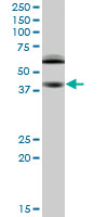 RING1 Antibody - RING1 monoclonal antibody (M03), clone 2B3. Western blot of RING1 expression in RIN-m5F.