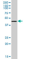 RING1 Antibody - RING1 monoclonal antibody (M07), clone 4E8. Western blot of RING1 expression in HeLa NE.